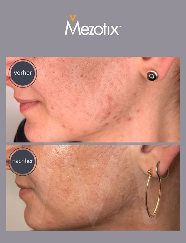 mztx_06