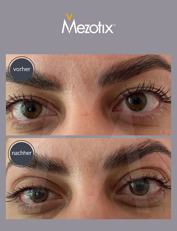 mztx_09